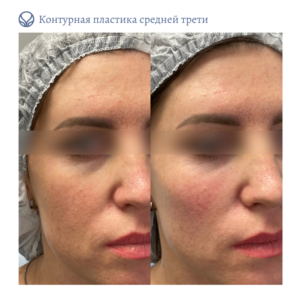 64844681__https://filllin.ru/api/media/doctor/cf7e885c-4955-470f-8c9f-b10da10aa8aa-6641d6971b708b73903b2c1d.png