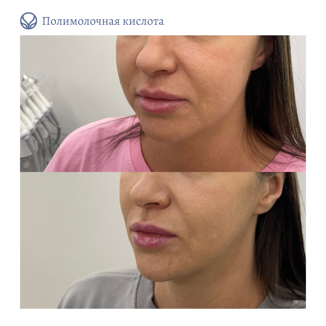 63423279__https://filllin.ru/api/media/doctor/cfa4911e-82bf-4e9d-add6-aeb970b37cd0-6641d6971b708b73903b2c1d.png