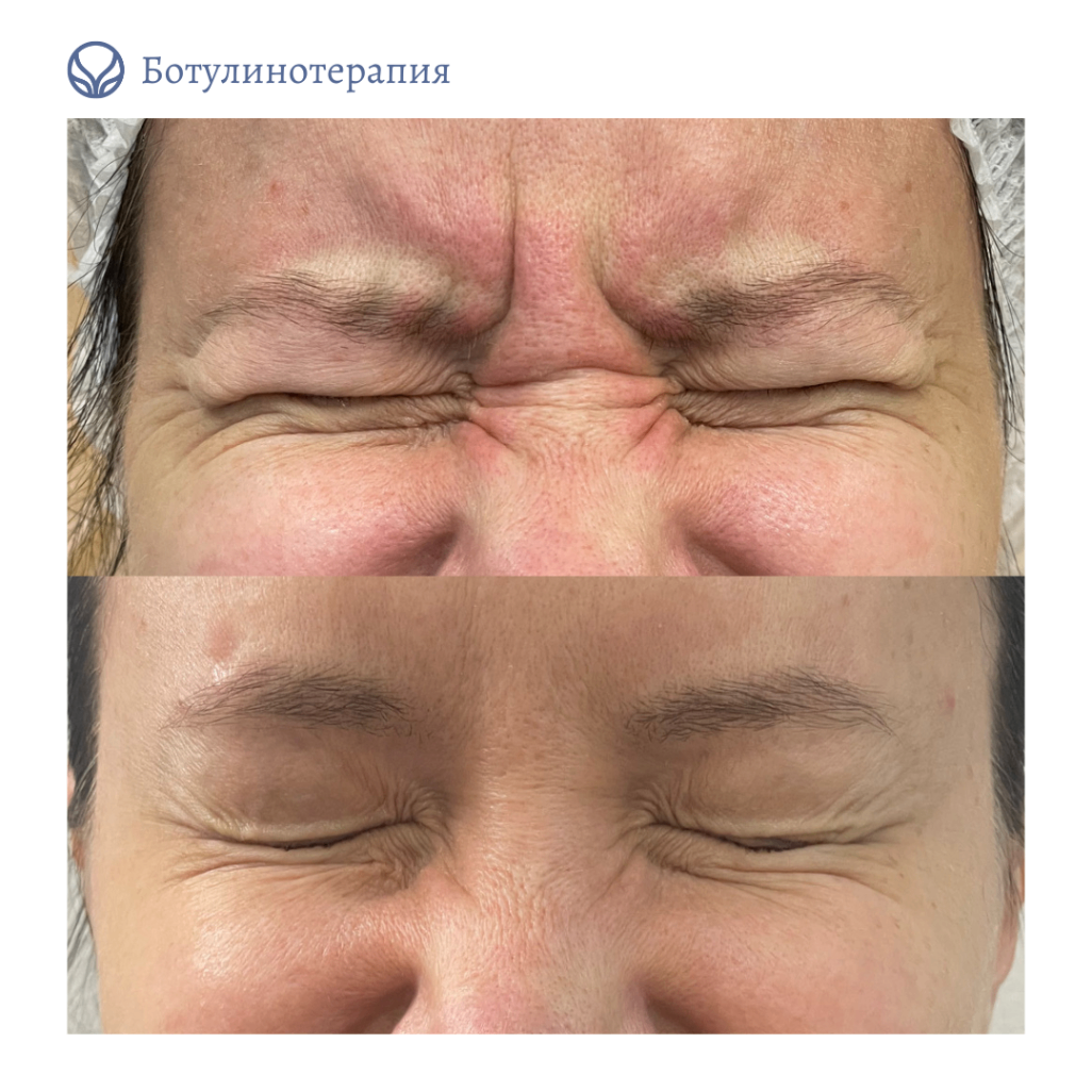 62014032__https://filllin.ru/api/media/doctor/d36aff07-2e56-41d8-b121-206f82f10283-6641d6971b708b73903b2c1d.png