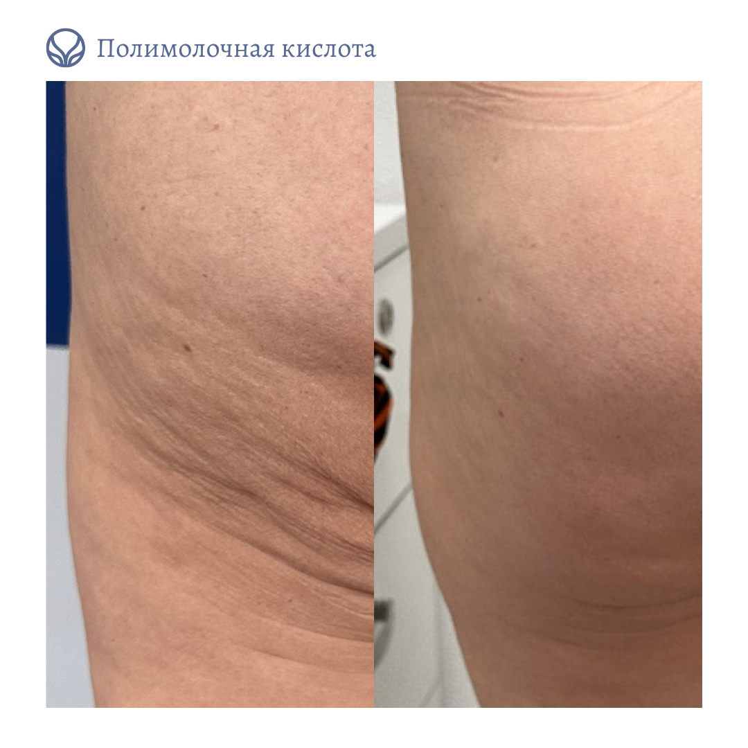 63423279__https://filllin.ru/api/media/doctor/d5a81f21-1013-4ab2-9706-8d7110183baf-6641d6971b708b73903b2c1d.png