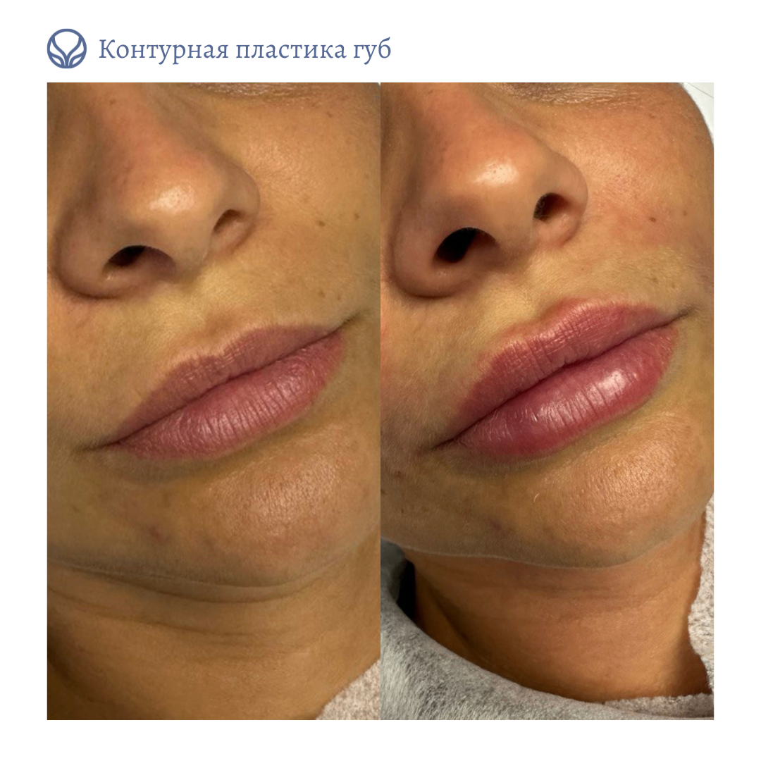 63553855__https://filllin.ru/api/media/doctor/d7de6e88-2803-49af-a39d-0fde5e271c42-6641d6971b708b73903b2c1d.png