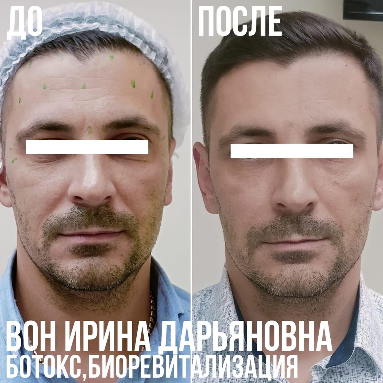 459598206__https://filllin.ru/api/media/doctor/d9b046d8-b681-4e1f-81c5-e3bab93ba5fa-6641d6971b708b73903b2c1d.jpg