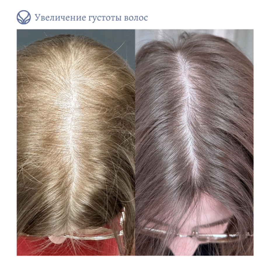 64844681__https://filllin.ru/api/media/doctor/da8fad99-0140-4eac-a1bc-ff4dd3bfd715-6641d6971b708b73903b2c1d.png