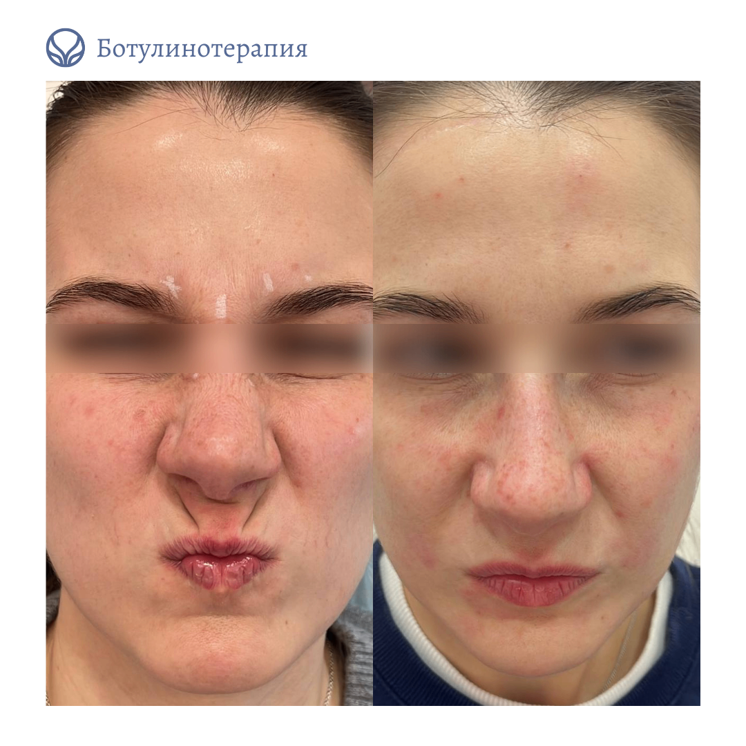 62014032__https://filllin.ru/api/media/doctor/dbac29cb-f3b9-49c6-8837-9f35624196c6-6641d6971b708b73903b2c1d.png