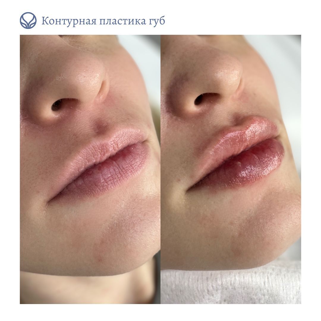 75035740__https://filllin.ru/api/media/doctor/dda2e55f-6ac7-4618-ae3a-05ffaa1da9c1-6641d6971b708b73903b2c1d.jpg