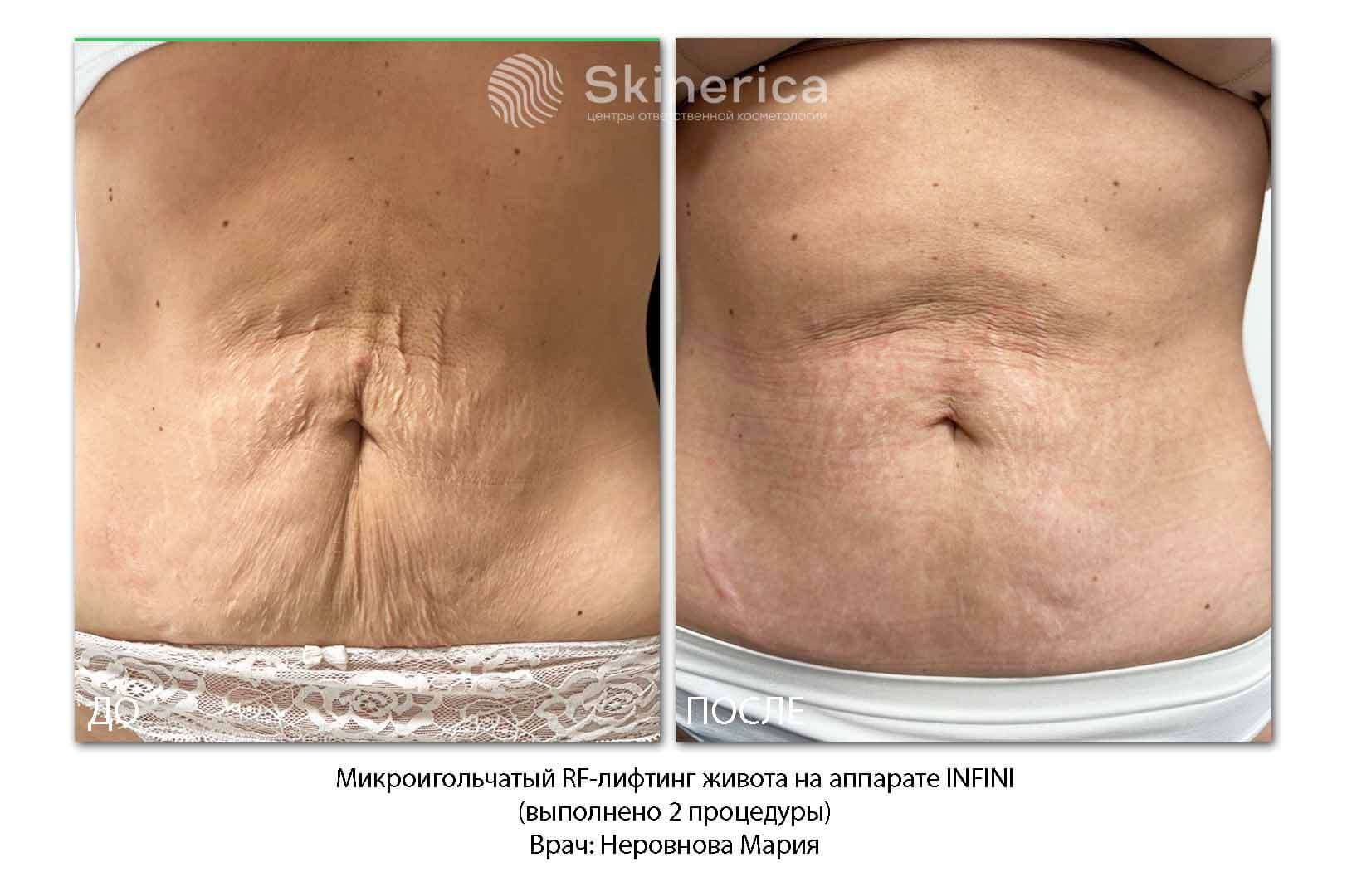 212022042__https://filllin.ru/api/media/doctor/df705f20-0623-40d0-8f84-38210c0c4028-6641d6971b708b73903b2c1d.jpg