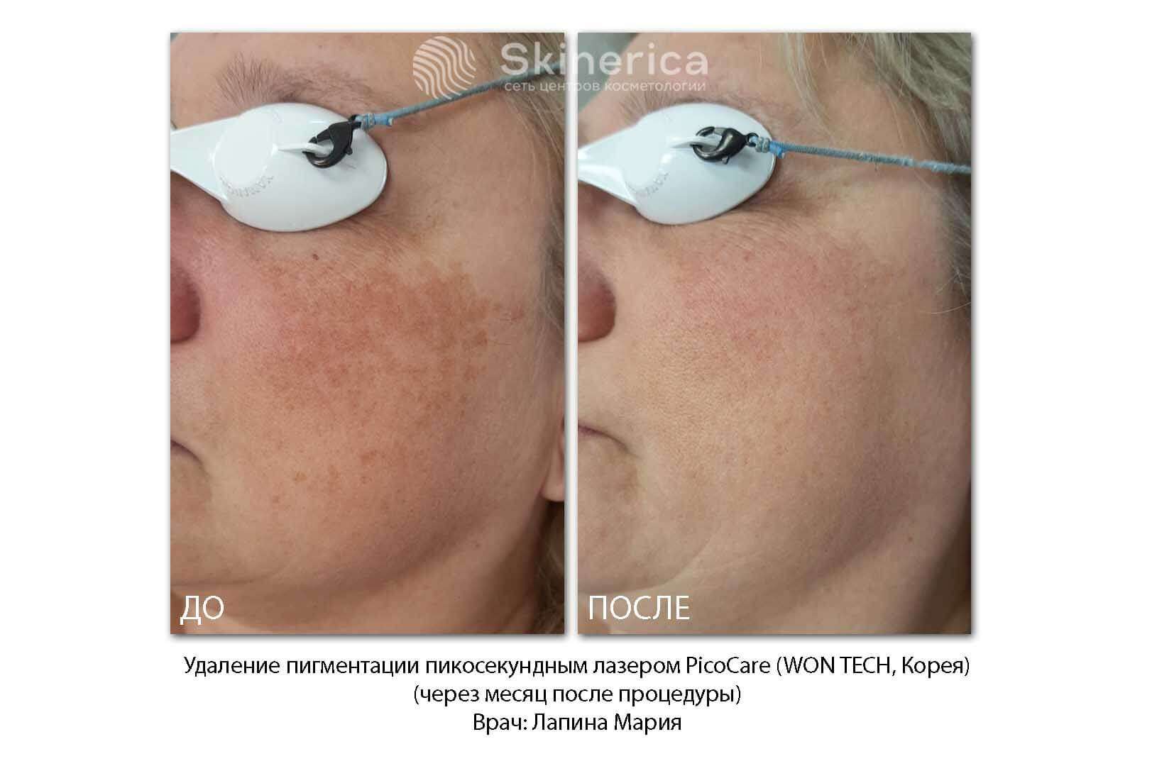 210725569__https://filllin.ru/api/media/doctor/e0ba3fec-c836-430c-ab4c-517878848495-6641d6971b708b73903b2c1d.jpg