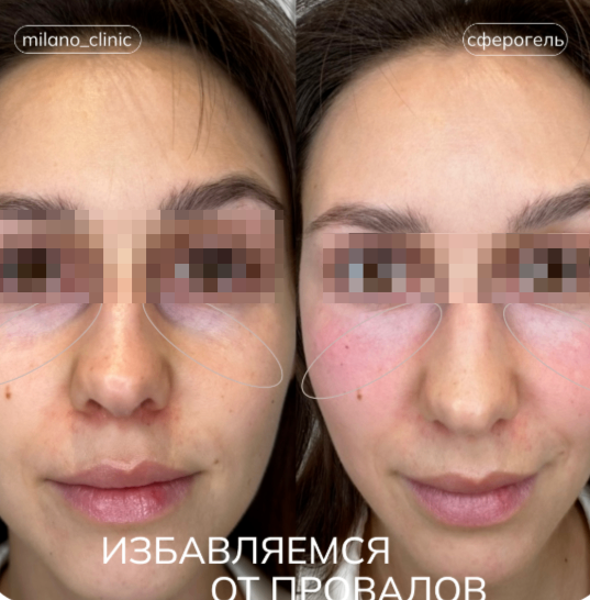 529020855__https://filllin.ru/api/media/doctor/e1555aa1-1fc0-4fc2-80d1-b7dfcafeb2e7-68d2b334d611ae3c0dcef079.png