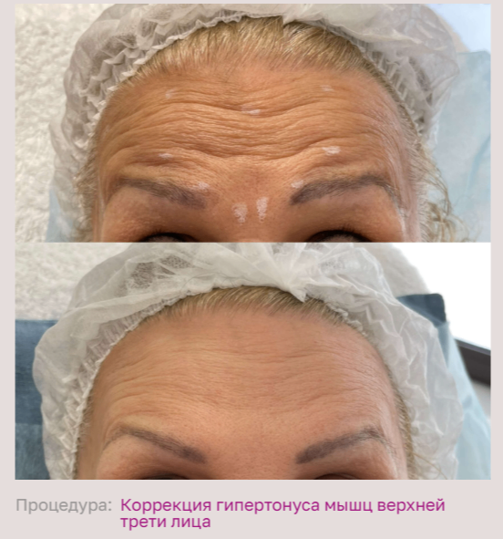 602492197__https://filllin.ru/api/media/doctor/e157b989-c138-4188-93a8-ccc1cf09b0f7-68d2b334d611ae3c0dcef079.png