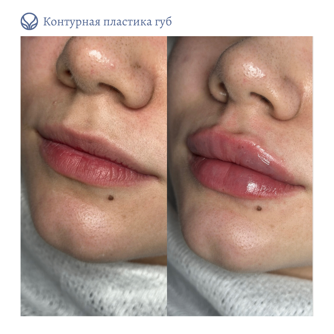 63423279__https://filllin.ru/api/media/doctor/e5e8ec33-68ed-49e3-8088-e4adcbf58f05-6641d6971b708b73903b2c1d.png