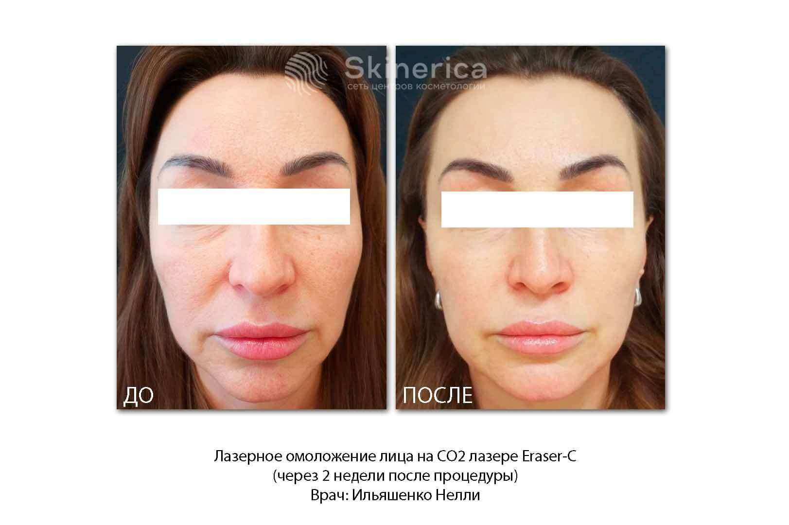 210741873__https://filllin.ru/api/media/doctor/e703d5f9-3f28-478f-aa17-30c06f09d0a5-6641d6971b708b73903b2c1d.jpg