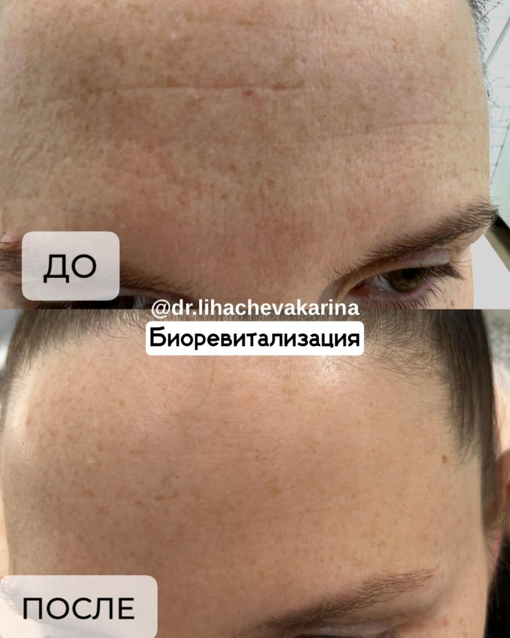 352217649__https://filllin.ru/api/media/doctor/e78a395f-d6da-455d-bcd9-634b6acf4f53-6641d6971b708b73903b2c1d.jpg