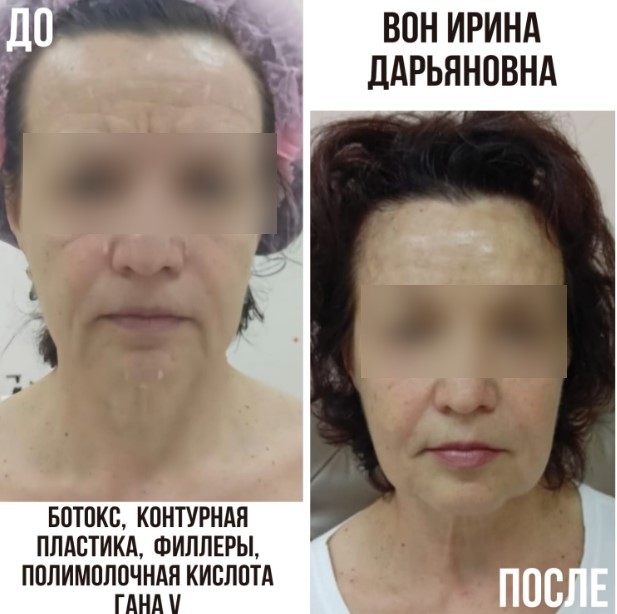 459598206__https://filllin.ru/api/media/doctor/e919db86-3b81-4acc-819f-d59f73f45265-6641d6971b708b73903b2c1d.jpg