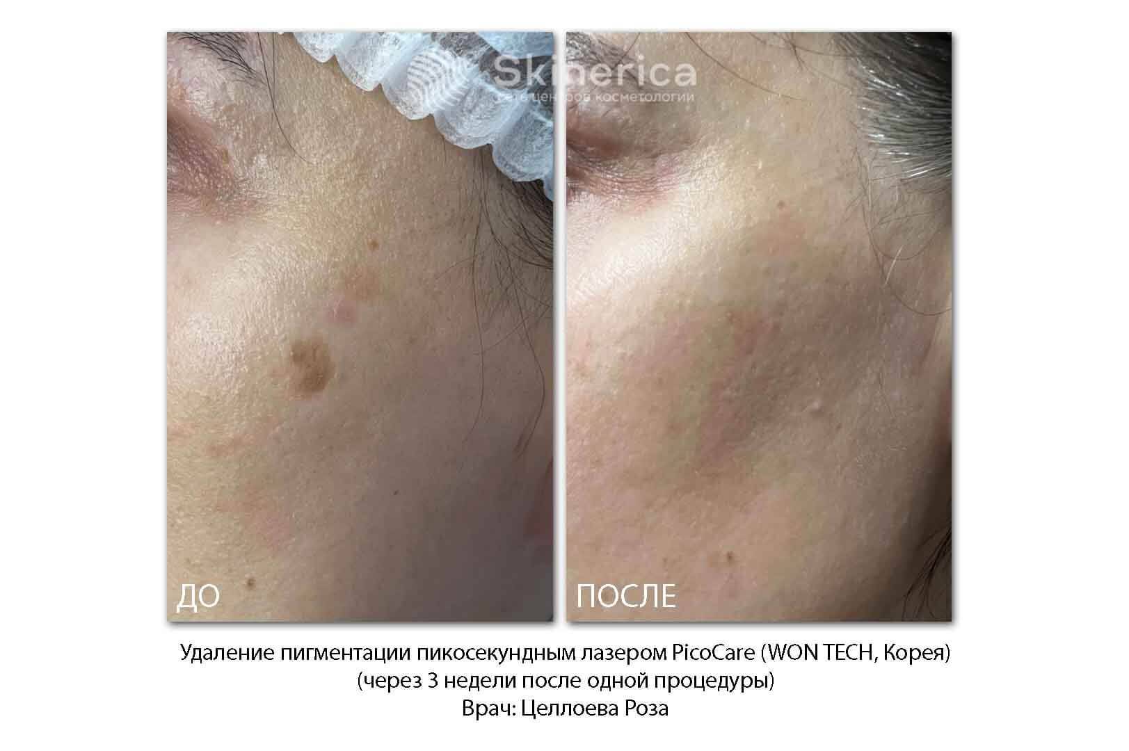 210725569__https://filllin.ru/api/media/doctor/eac4c0dc-e804-4664-9baf-d0fcde8744be-6641d6971b708b73903b2c1d.jpg
