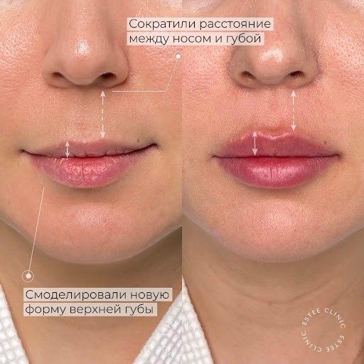 135377169__https://filllin.ru/api/media/doctor/ec1d0c04-90d3-455b-a569-7c33bcf6d5df-6641d6971b708b73903b2c1d.jpg