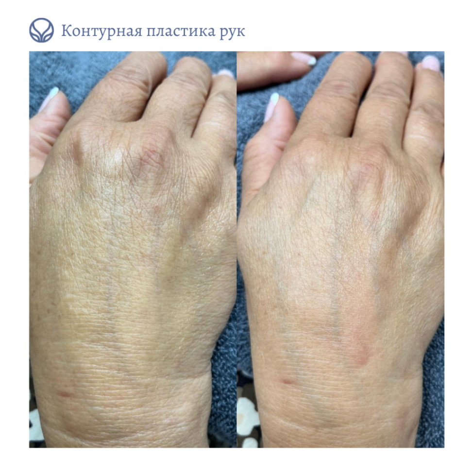 69043717__https://filllin.ru/api/media/doctor/ec8175b8-4236-4811-9d92-c847ce34797c-6641d6971b708b73903b2c1d.png