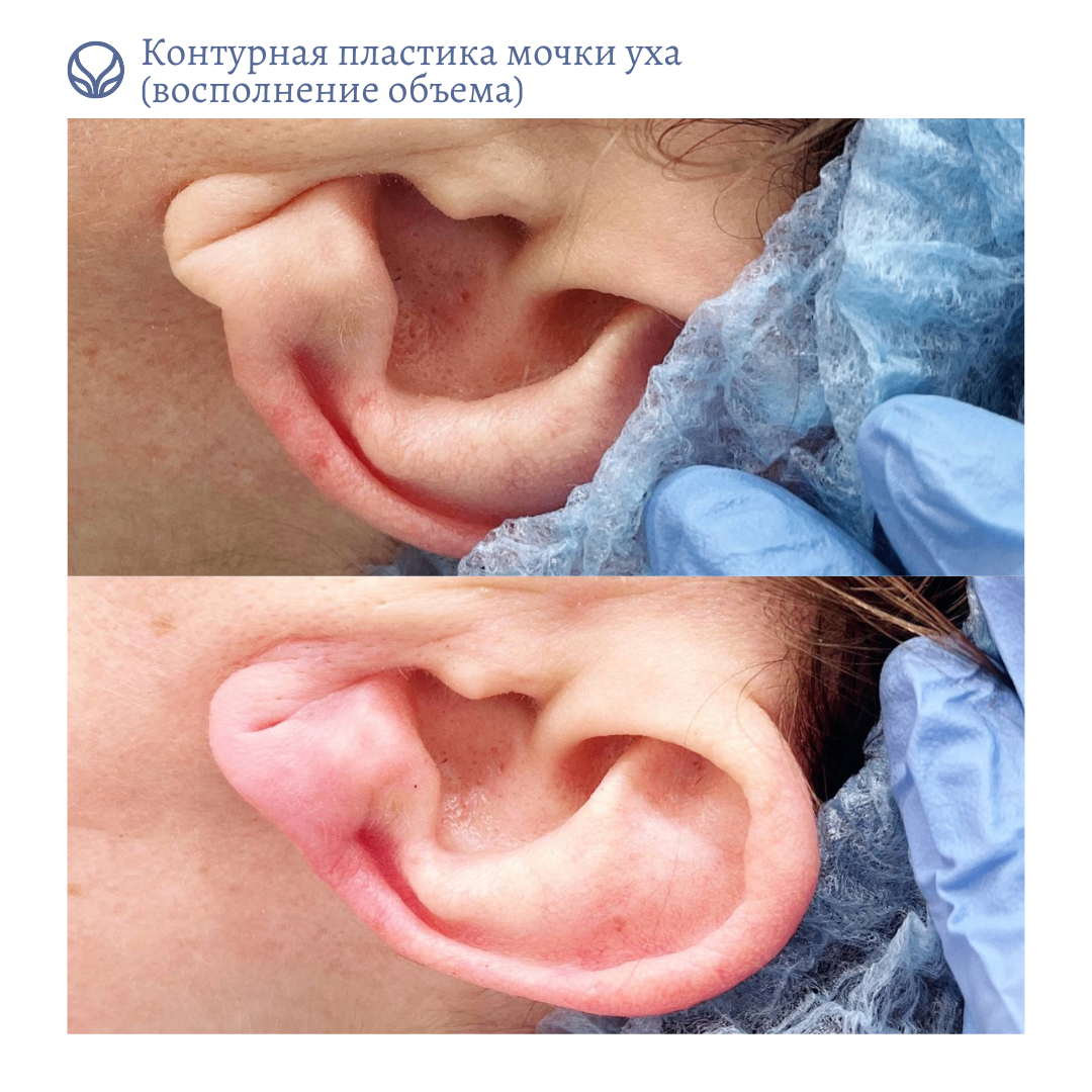 69138892__https://filllin.ru/api/media/doctor/ecce8eaf-57f0-4677-b8f5-dc7258e9e780-6641d6971b708b73903b2c1d.png