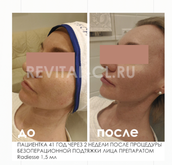 209665964__https://filllin.ru/api/media/doctor/f078c078-edba-4f11-960b-f72ac558d25b-6641d6971b708b73903b2c1d.png