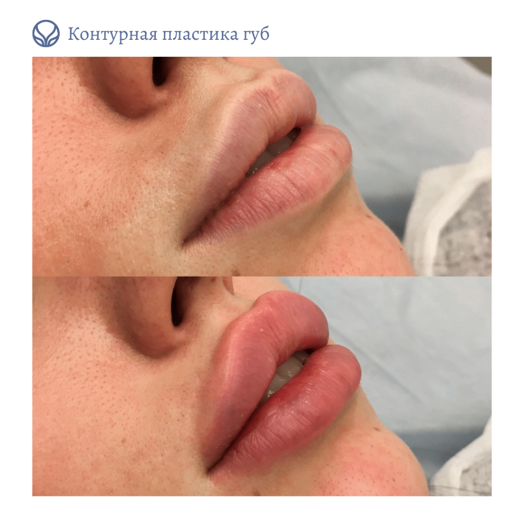 63550010__https://filllin.ru/api/media/doctor/f25d9014-b907-49a2-9e9d-640e1a1ac3cb-6641d6971b708b73903b2c1d.png
