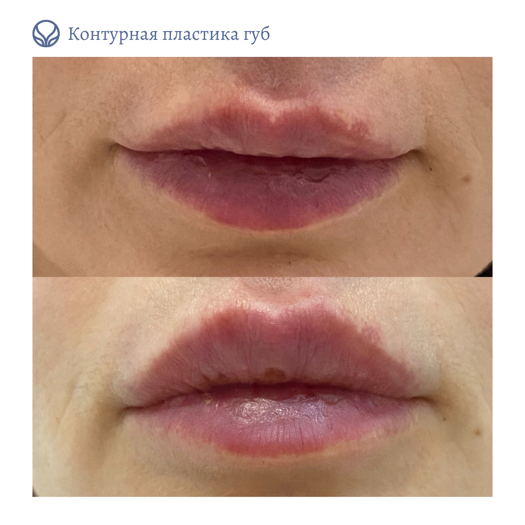 68347819__https://filllin.ru/api/media/doctor/f356682b-9f22-493c-8b57-41e3250d3929-6641d6971b708b73903b2c1d.png