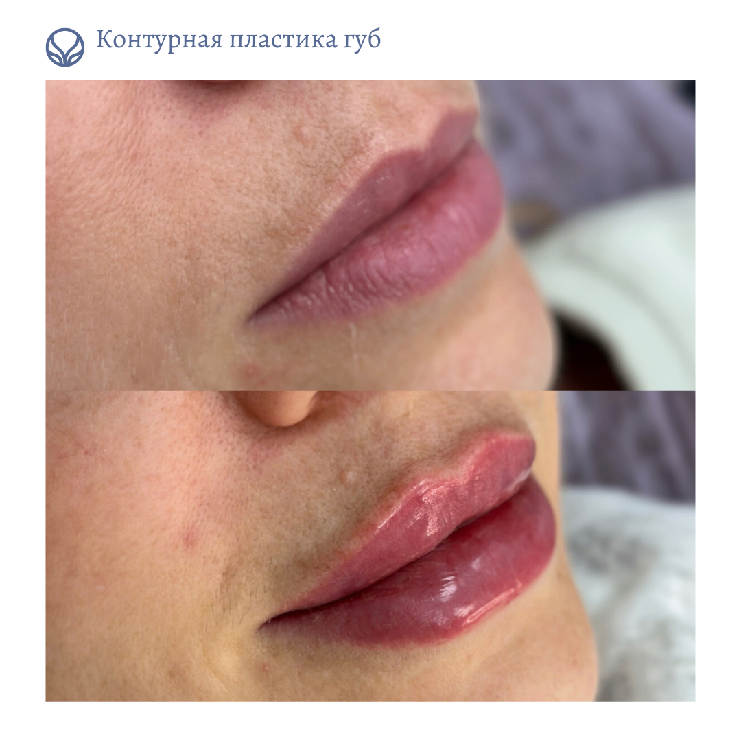 63423279__https://filllin.ru/api/media/doctor/f55b624b-b9c4-498b-8340-86c1e4f244bb-6641d6971b708b73903b2c1d.png