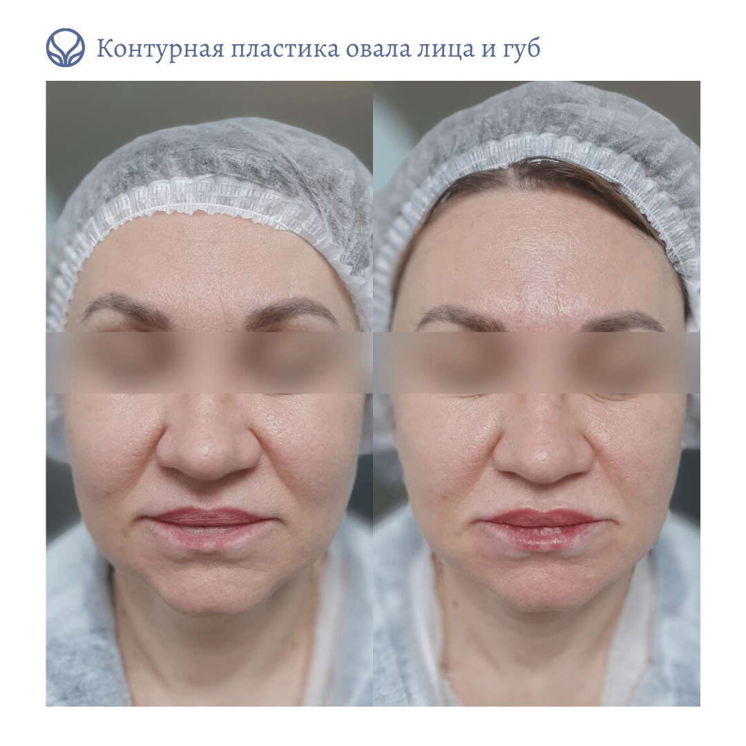 67216317__https://filllin.ru/api/media/doctor/f6a71904-a5d4-44c3-9784-8066992d69cc-6641d6971b708b73903b2c1d.png