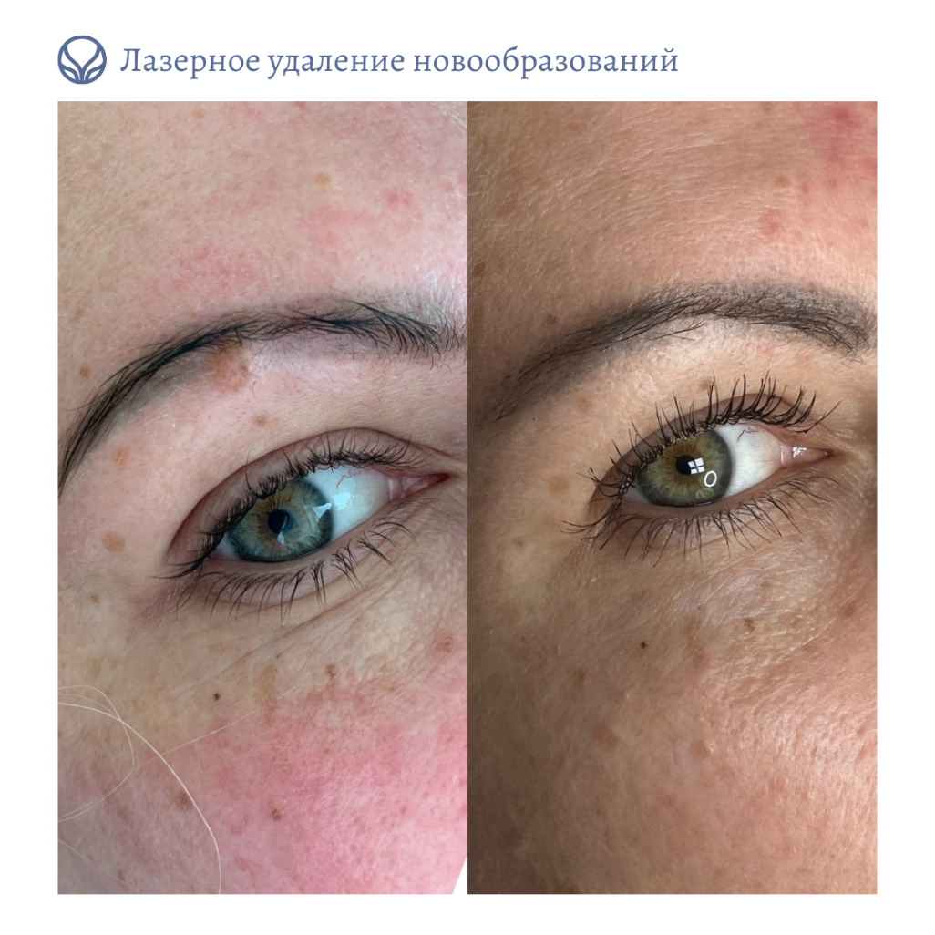 64764445__https://filllin.ru/api/media/doctor/f7e04f56-a64a-4137-bca9-d0d6b85f425e-6641d6971b708b73903b2c1d.png