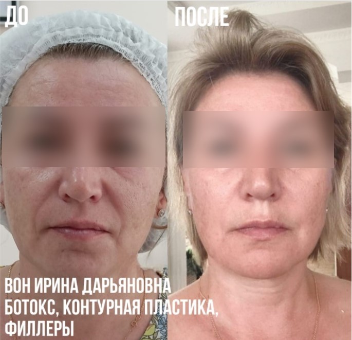 459598206__https://filllin.ru/api/media/doctor/f9c632a4-f6e8-4fd0-bbea-483288609542-6641d6971b708b73903b2c1d.jpg