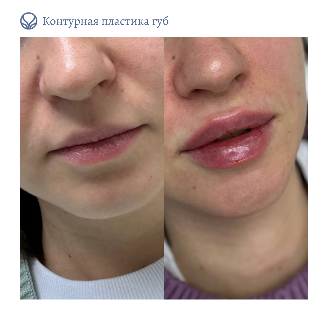 66825615__https://filllin.ru/api/media/doctor/fbf99e1d-9562-468c-85a2-2192ec85f615-6641d6971b708b73903b2c1d.png