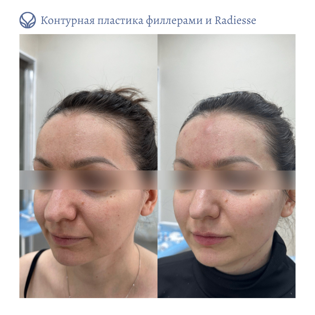63423279__https://filllin.ru/api/media/doctor/fc8ed34e-24a9-4a20-9822-f321682428b2-6641d6971b708b73903b2c1d.png