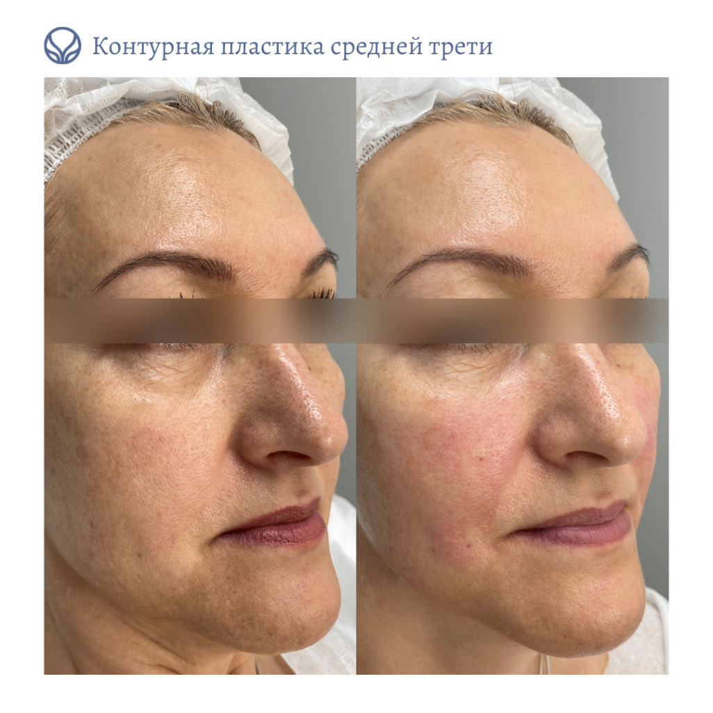 64844681__https://filllin.ru/api/media/doctor/fcc6c9d5-ba7f-4751-a34c-0fbefb64a1d7-6641d6971b708b73903b2c1d.png