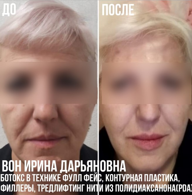 459598206__https://filllin.ru/api/media/doctor/fce390b1-1ac5-425d-b154-203981aa40e9-6641d6971b708b73903b2c1d.jpg