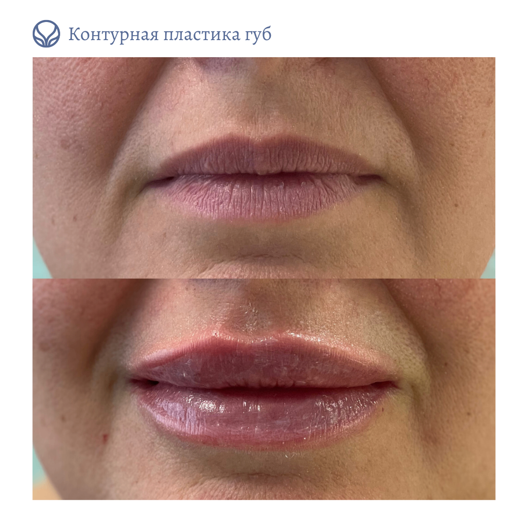 69118769__https://filllin.ru/api/media/doctor/fd0de48b-c4b2-4726-8309-63260ce777c9-6641d6971b708b73903b2c1d.png