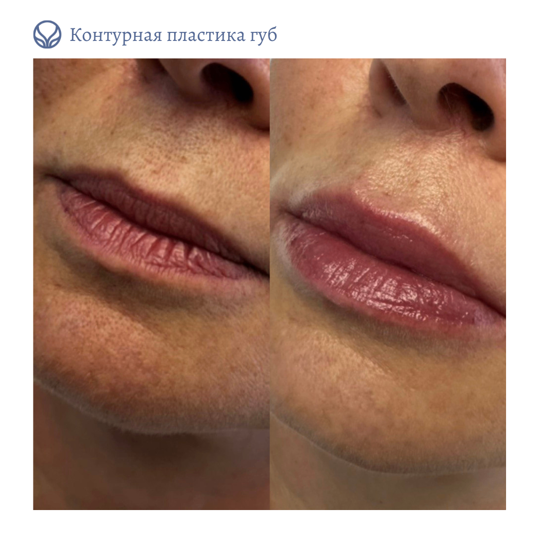 63553855__https://filllin.ru/api/media/doctor/fd646314-35f0-49df-94e3-60392b4eca65-6641d6971b708b73903b2c1d.png