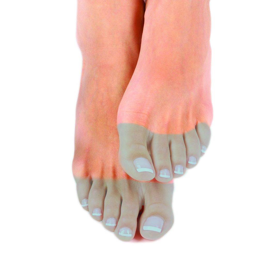 Лазерная эпиляция для женщин: пальцы ног