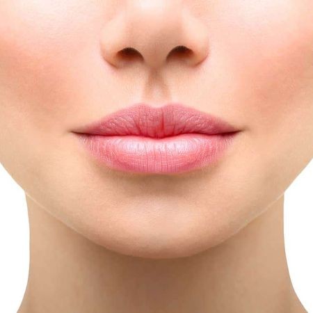 Увеличение губ препаратом Neuramis Deep (1 мл)