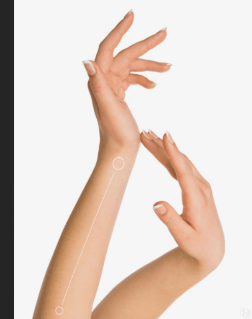 Лазерная эпиляция для женщин: кисти рук