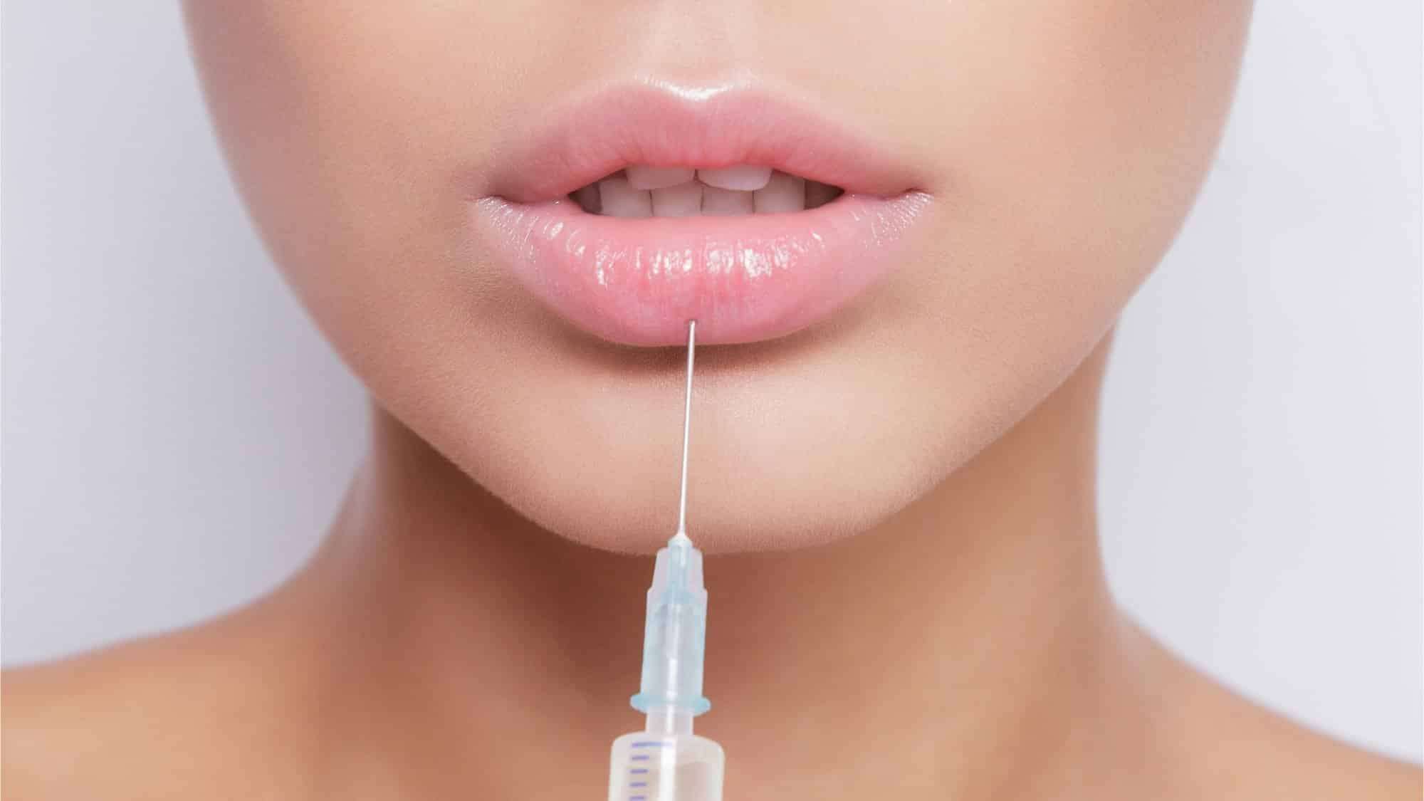 Контурная пластика губ препаратом Belotero Intense 1.0