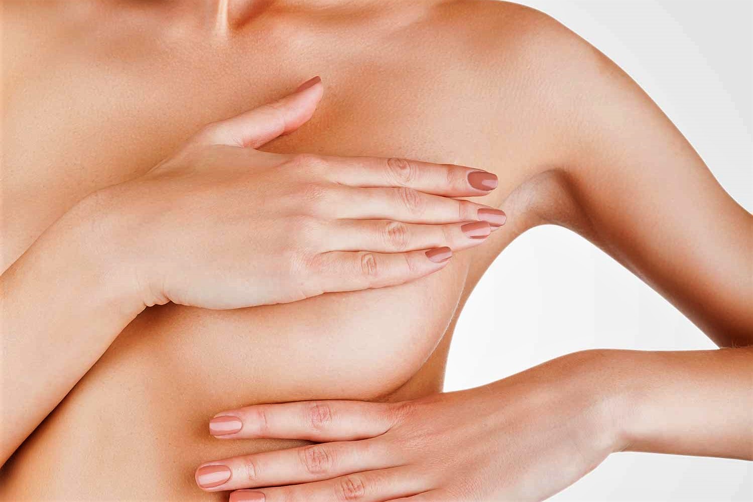 Лечение Растяжек зона груди