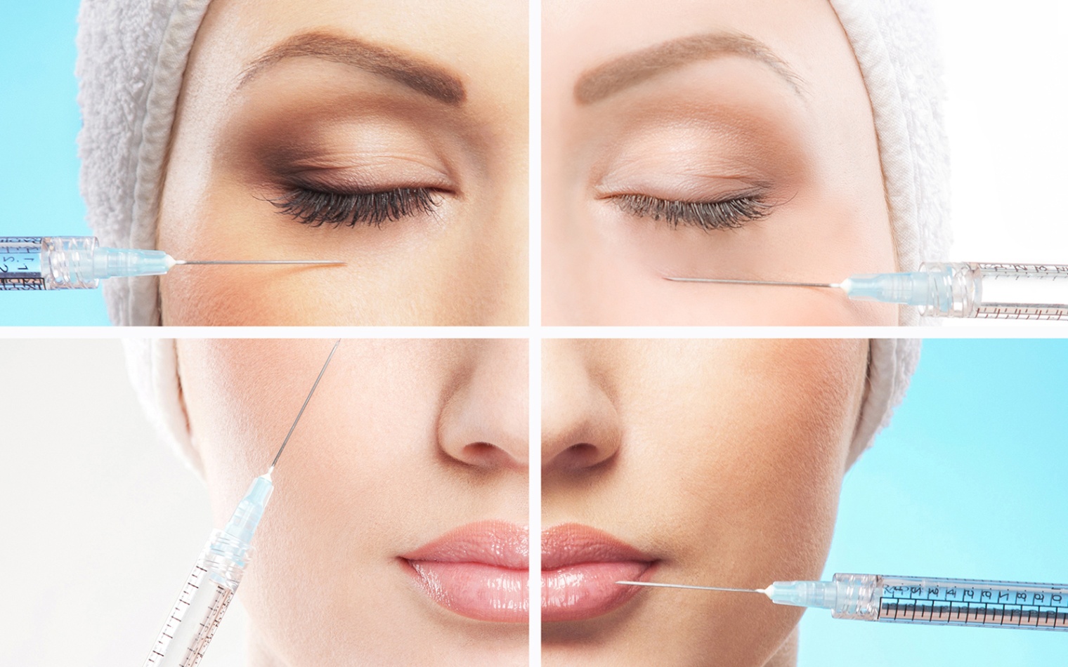 Процедура контурной пластики лица - коррекция глубоких морщин, увеличение объема губ