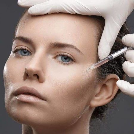 Миотокс: лоб + межбровье + зона глаз (39 ед) Акция НОЯБРЯ!