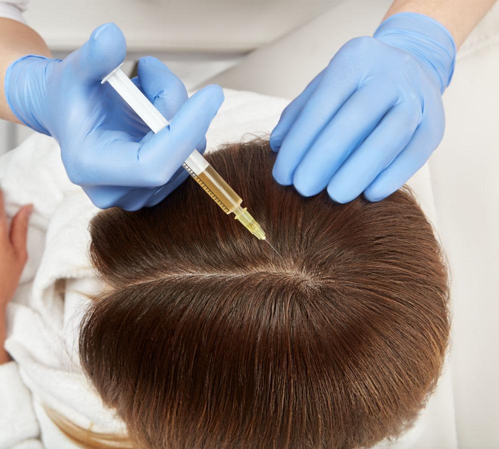 Мезотерапия препаратом BioCascad (1 мл): волосистая часть кожи головы
