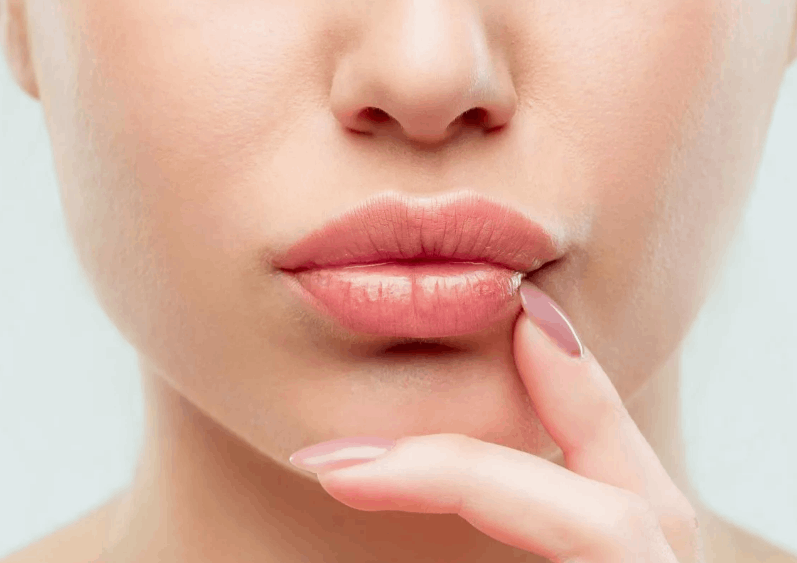 Увеличение губ препаратом Juvederm VoLift  (1 мл)