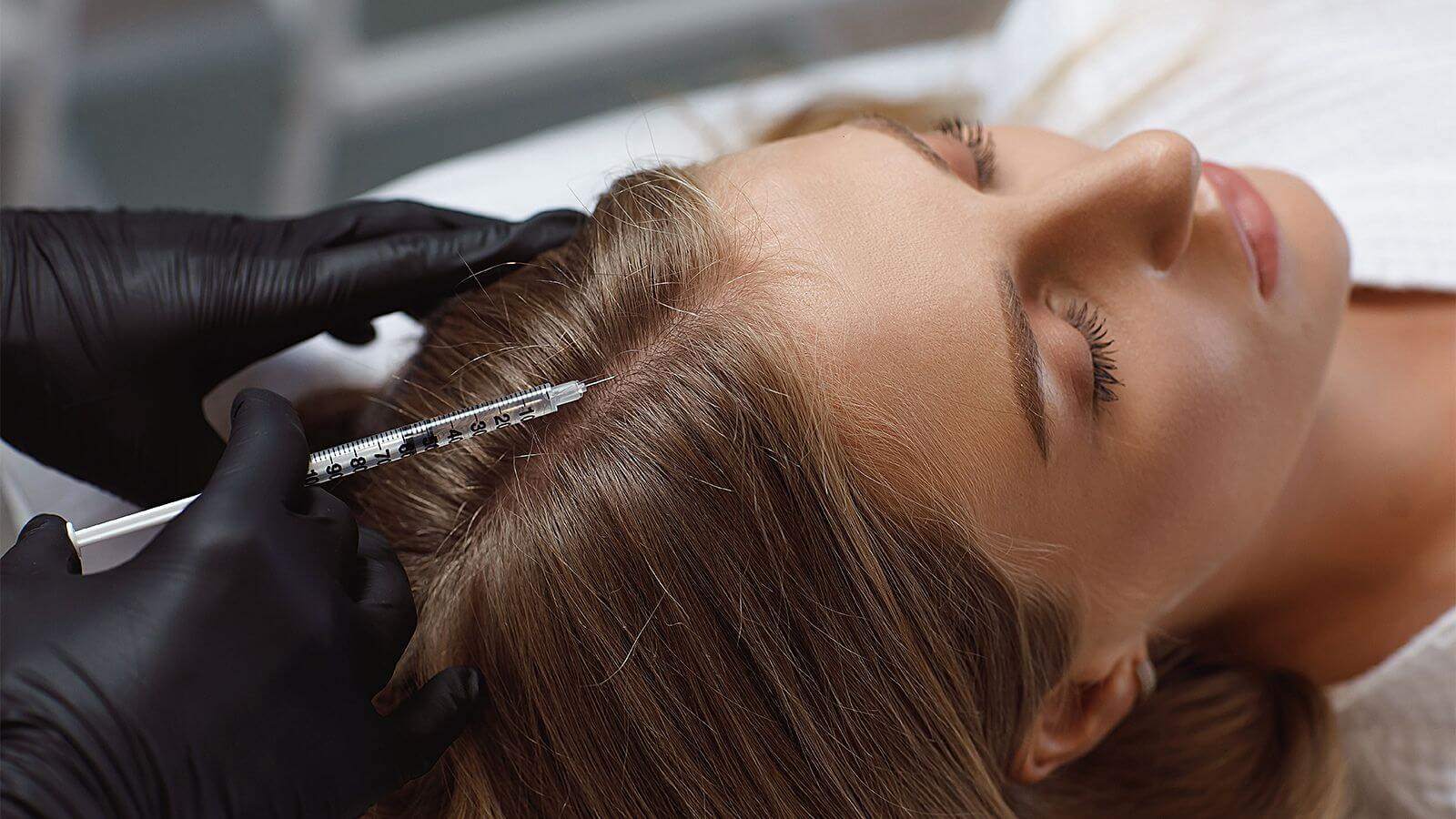Мезотерапия препаратом Fusion Meso F-Hair (5 мл): волосистая часть кожи головы