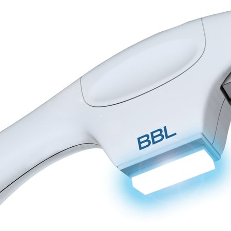 Фотоомоложение BBL (Skin Tyte): лицо + шея