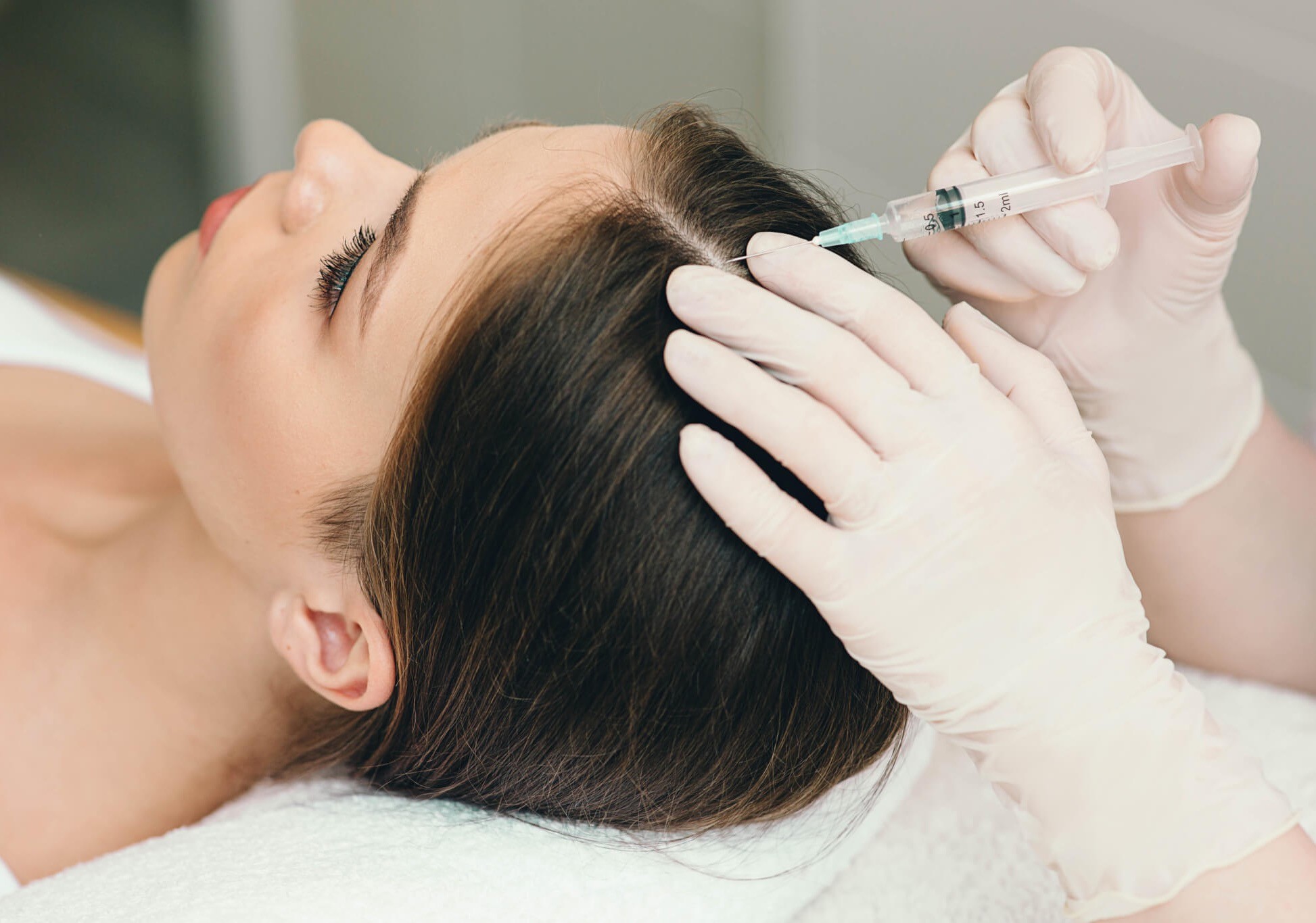 Мезотерапия кожи головы препаратом «Vita Line»,  HairMaxx 