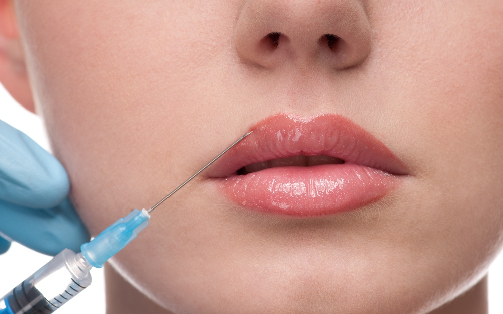 Увеличение губ препаратом Аrt Filler Lips (1мл)