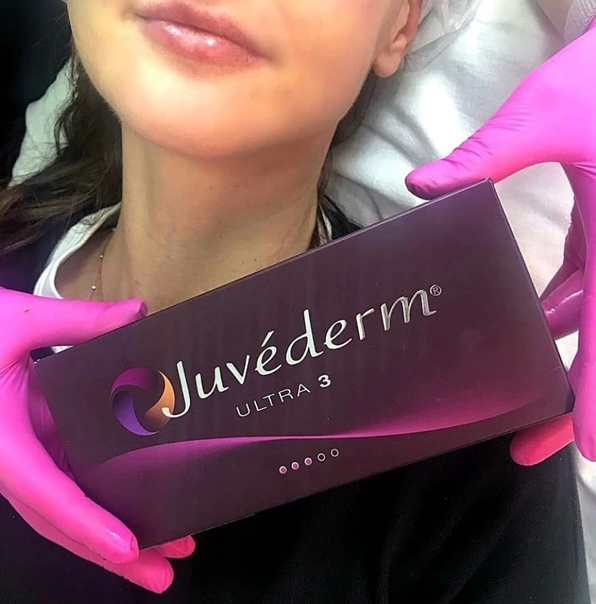 Контурная пластика препаратом Juvederm Ultra 3 (1 мл)