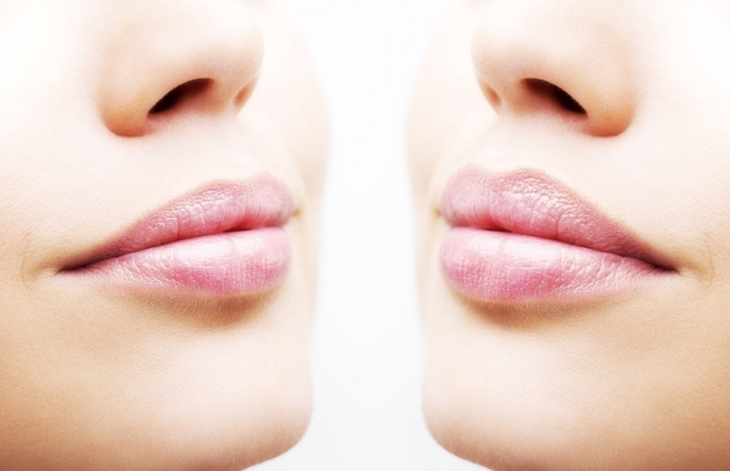 Увеличение губ Belotero Lips Shape (0,55 мл)