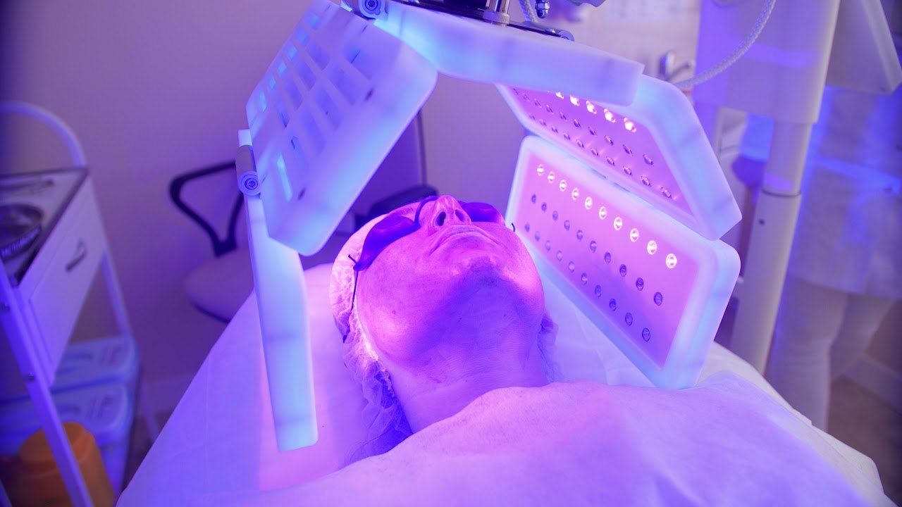 Фотодинамическая терапия HELEO4 AntiAcne лицо+шея 1 процедура